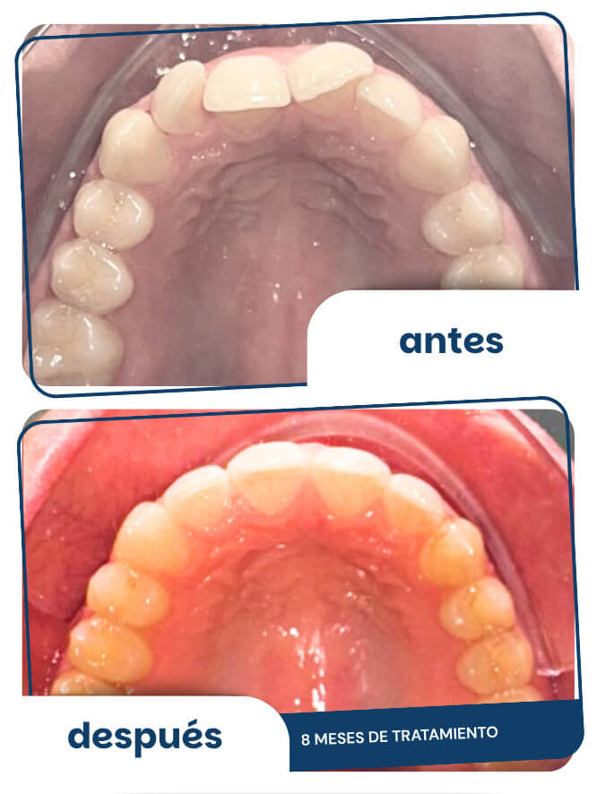 antes-despues-2
