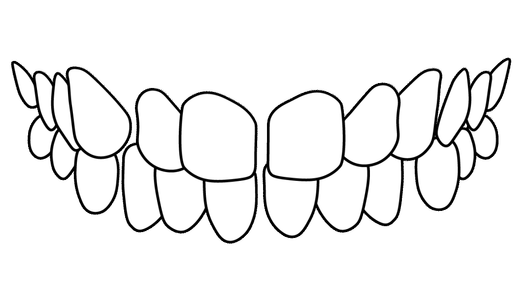 dientes-separados