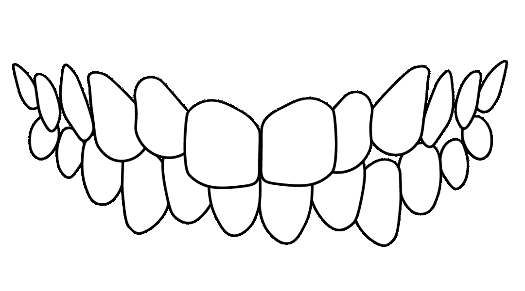 dientes-torcidos